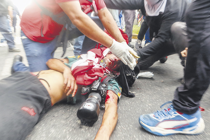 Decenas de heridos y más de cien detenidos durante protesta de jubilados enP Argentina