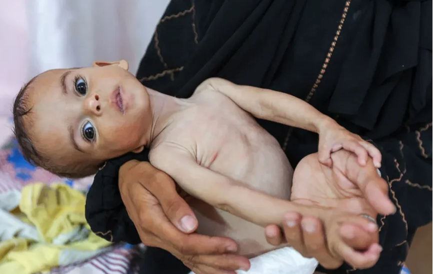 Seela Barbakh, una niña palestina de 11 meses que, según los médicos, está desnutrida, es sostenida por su madre Najah en el Hospital Nasser en Khan Younis, Gaza, el miércoles.