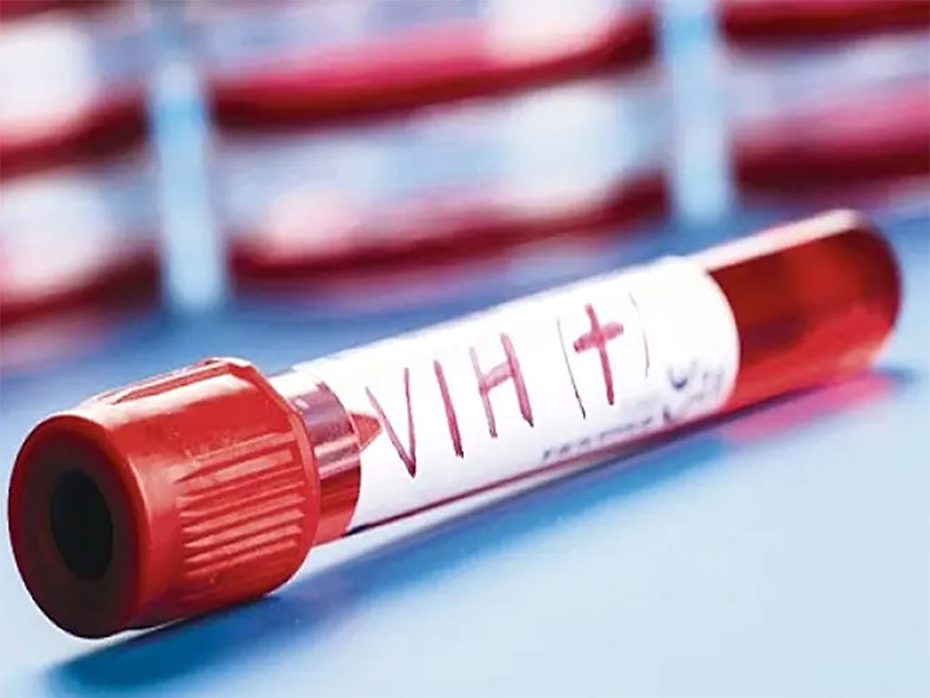 Test de VIH