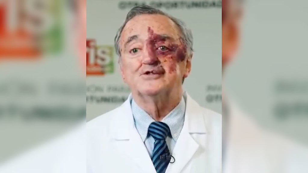 El médico español, Mariano Barbacid, explicó que su equipo ha diseñado una triple terapia capaz de provocar la regresión del tumor, y confía en que en un plazo de tres años pueda aplicarse en ensayos clínicos con pacientes.